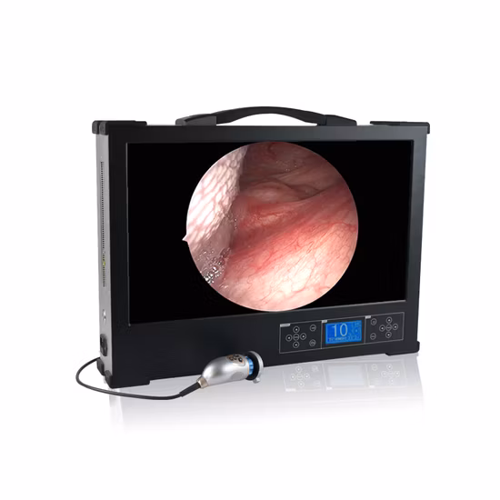 耳鼻咽喉科内視鏡システムおよびポータブル内視鏡カメラ腹腔鏡内視鏡泌尿器科内視鏡